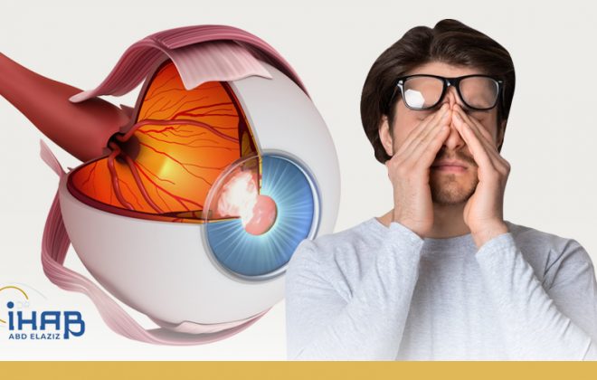 علاج عصب العين