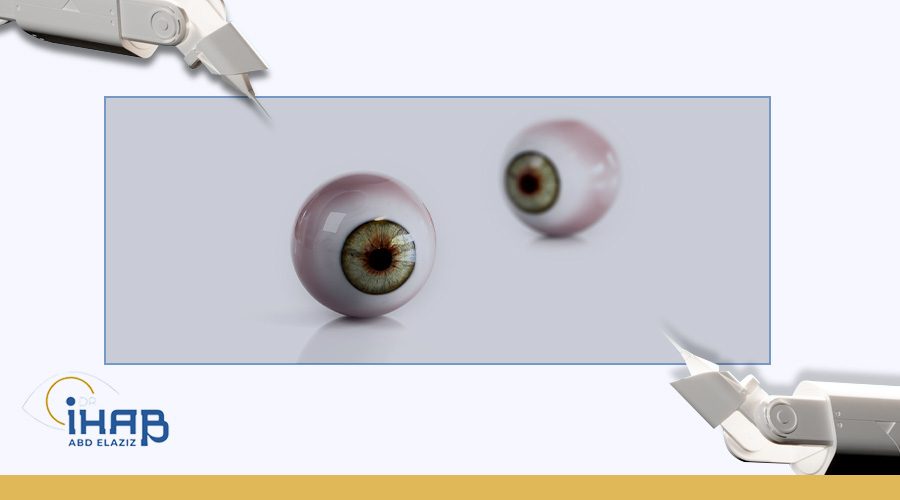 أنواع عمليات جراحة العيون