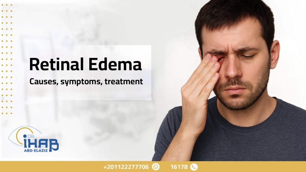 Retinal Edema ( Macular edema ) Causes and Treatment | Dr. Ehab Abdelaziz 1 A close-up of a human eye showing signs of retinal edema and macular fluid accumulation