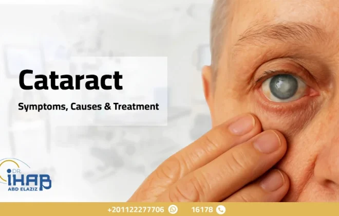 Cataract: Symptoms, Causes & Treatment