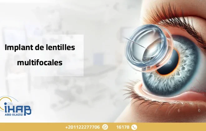 Implant de Lentilles Multifocales : Correction de la Vision