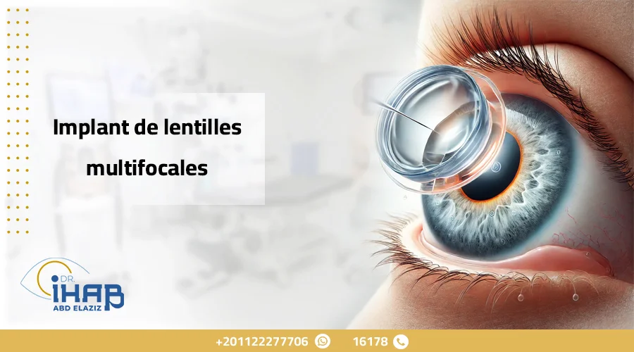 Implant de Lentilles Multifocales : Correction de la Vision