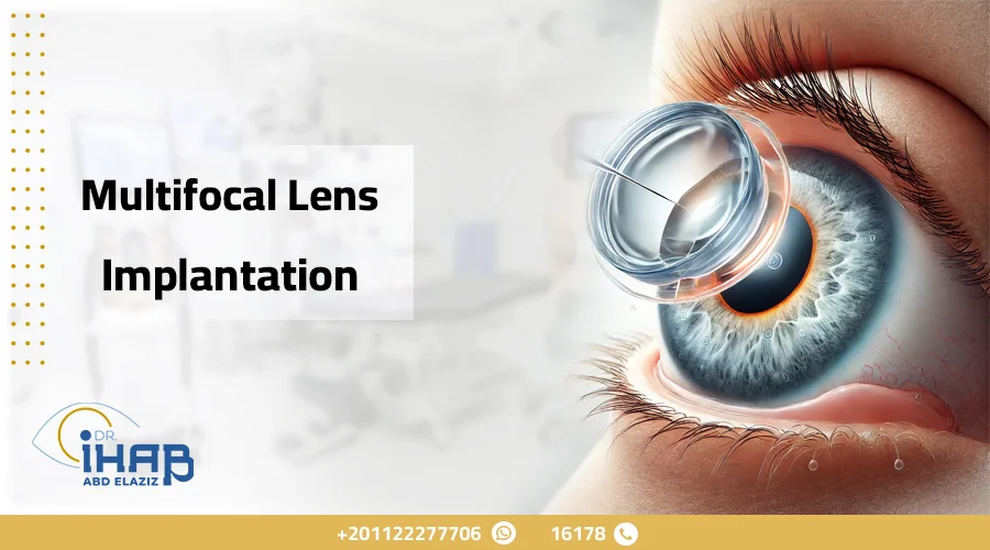 Multifocal Lens Implantation: A Permanent Solution for Vision