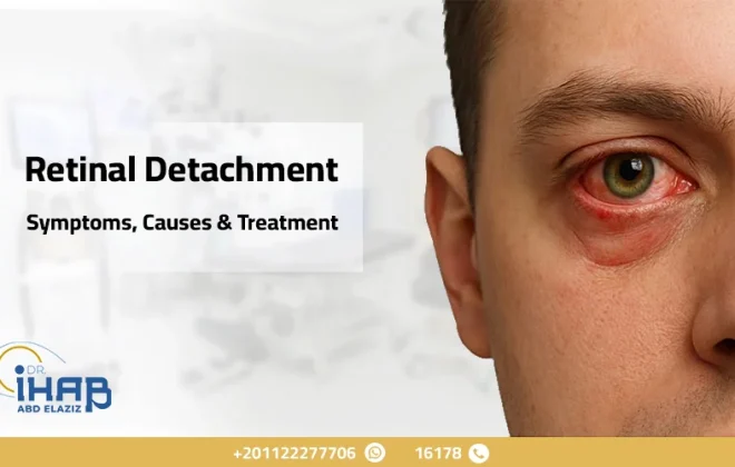 Retinal Detachment: Symptoms, Causes & Treatment