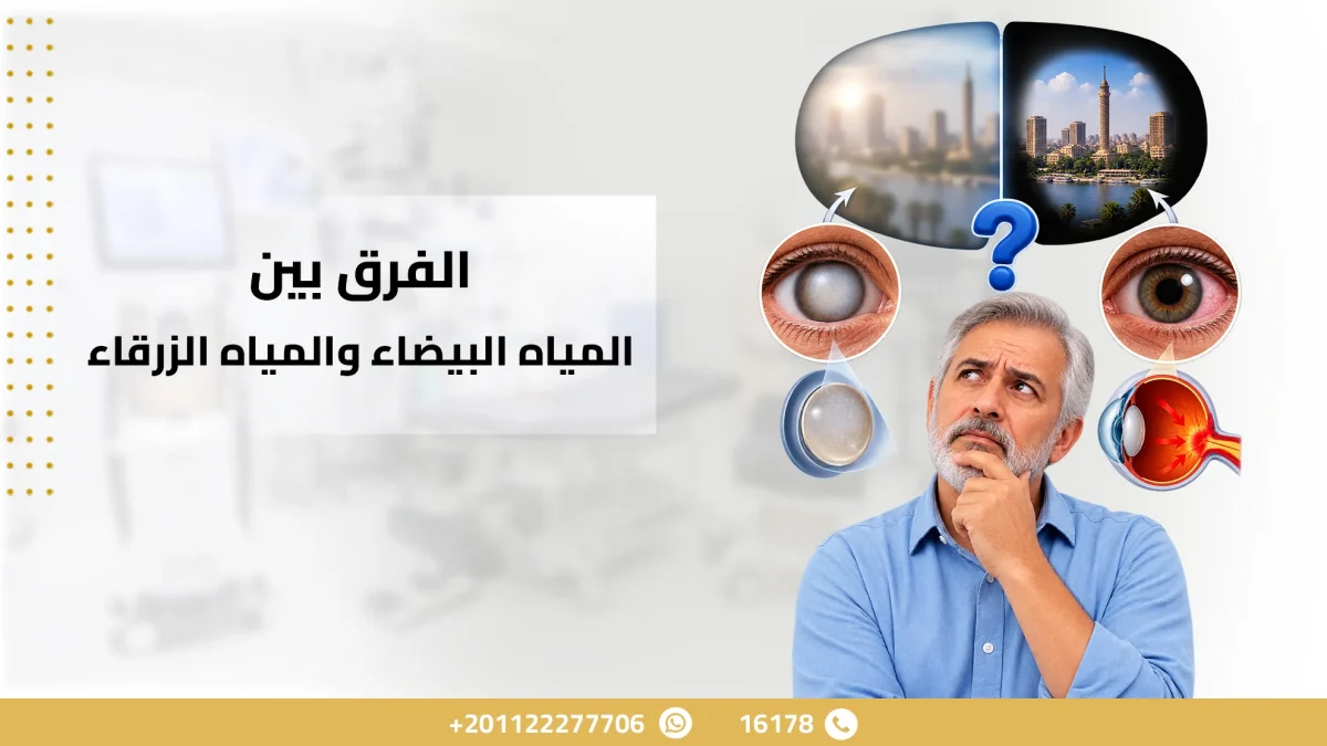 الفرق بين المياه البيضاء والمياه الزرقاء