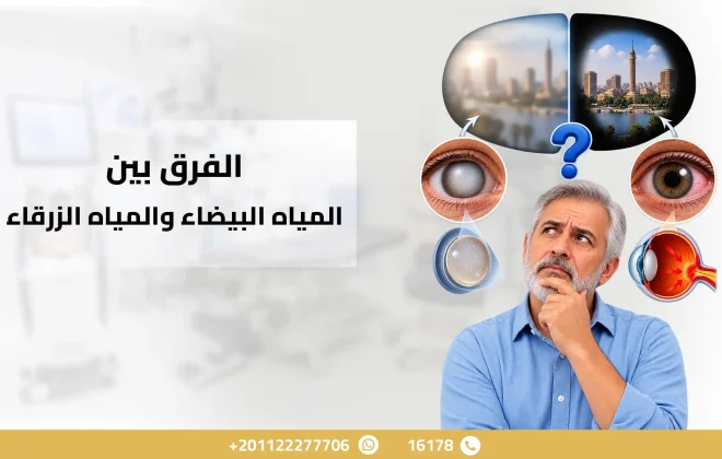 الفرق بين المياه البيضاء والمياه الزرقاء
