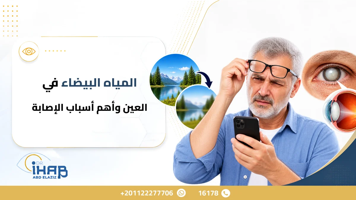 سبب المياه البيضاء في العين