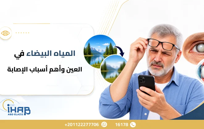 سبب المياه البيضاء في العين