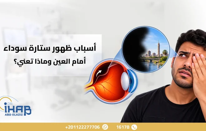 ستارة سوداء أمام العين