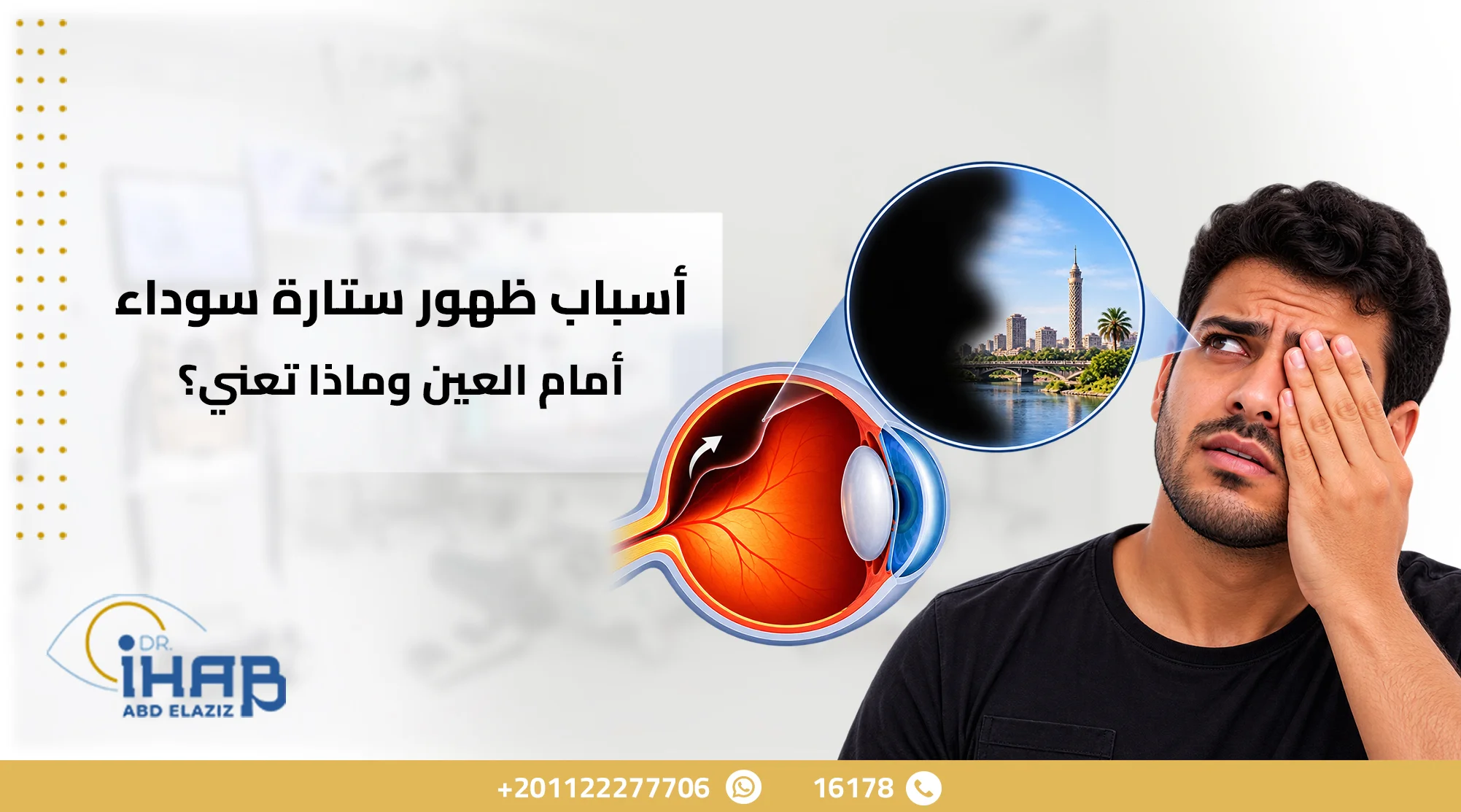 ستارة سوداء أمام العين