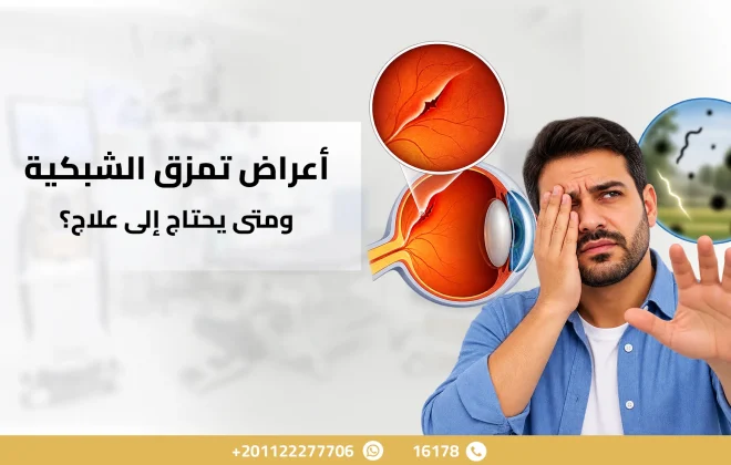 أعراض تمزق الشبكية