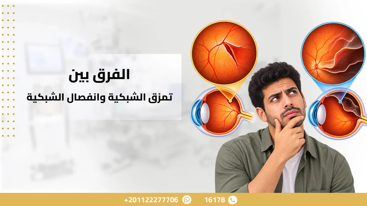 الفرق بين تمزق الشبكية وانفصال الشبكية