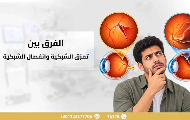 الفرق بين تمزق الشبكية وانفصال الشبكية