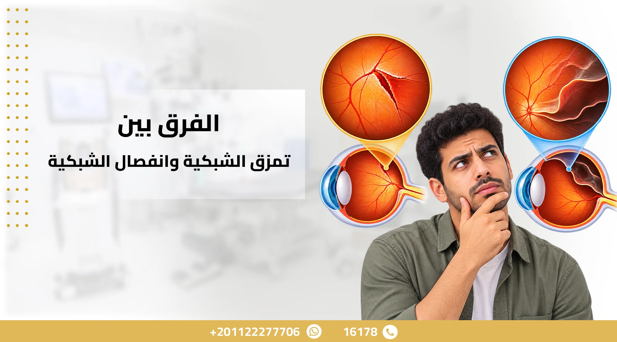 الفرق بين تمزق الشبكية وانفصال الشبكية: الأعراض والعلاج الفرق بين تمزق الشبكية وانفصال الشبكية