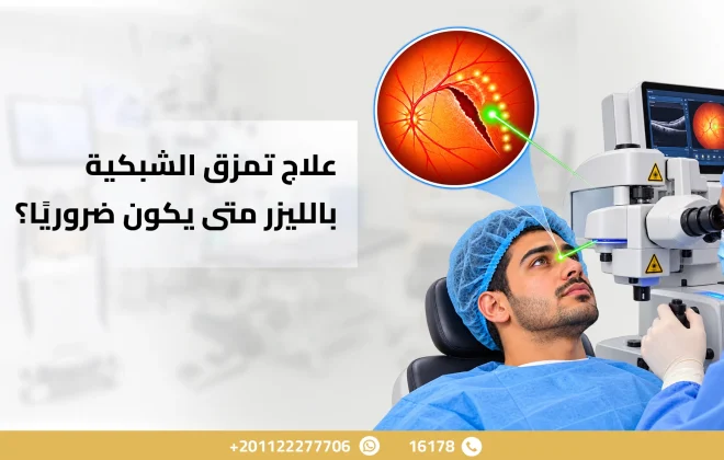 علاج تمزق الشبكية بالليزر